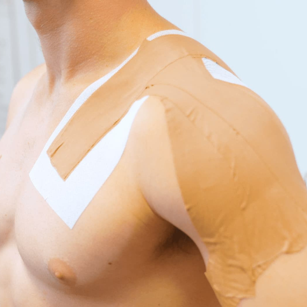 AC Shoulder Injury Taping