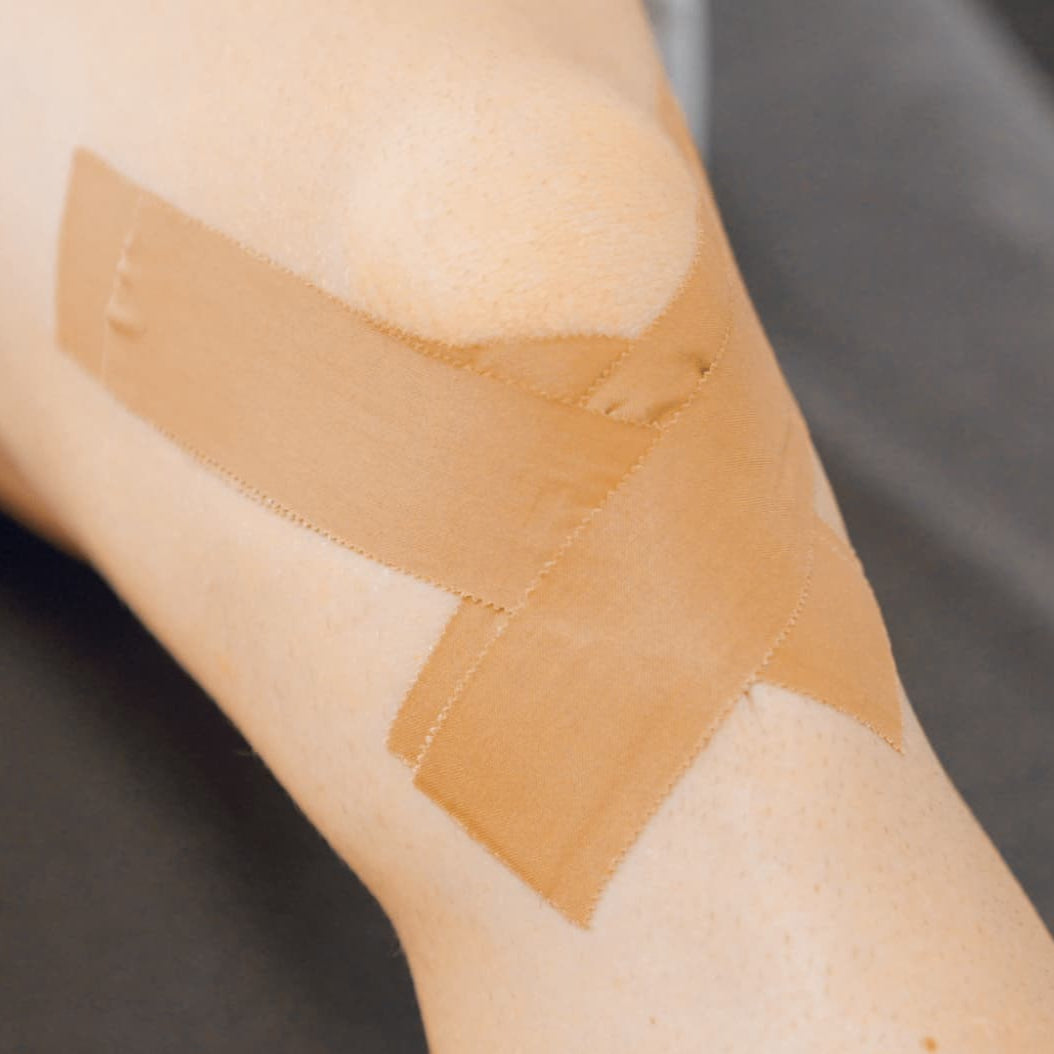Patella Tendon Taping